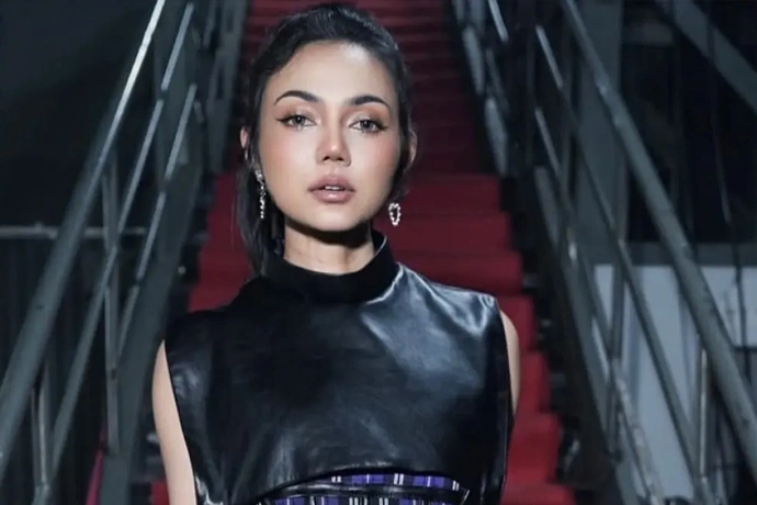 Rina Nose Mengaku Alami Post-Op Blues Usai Oplas Hidung